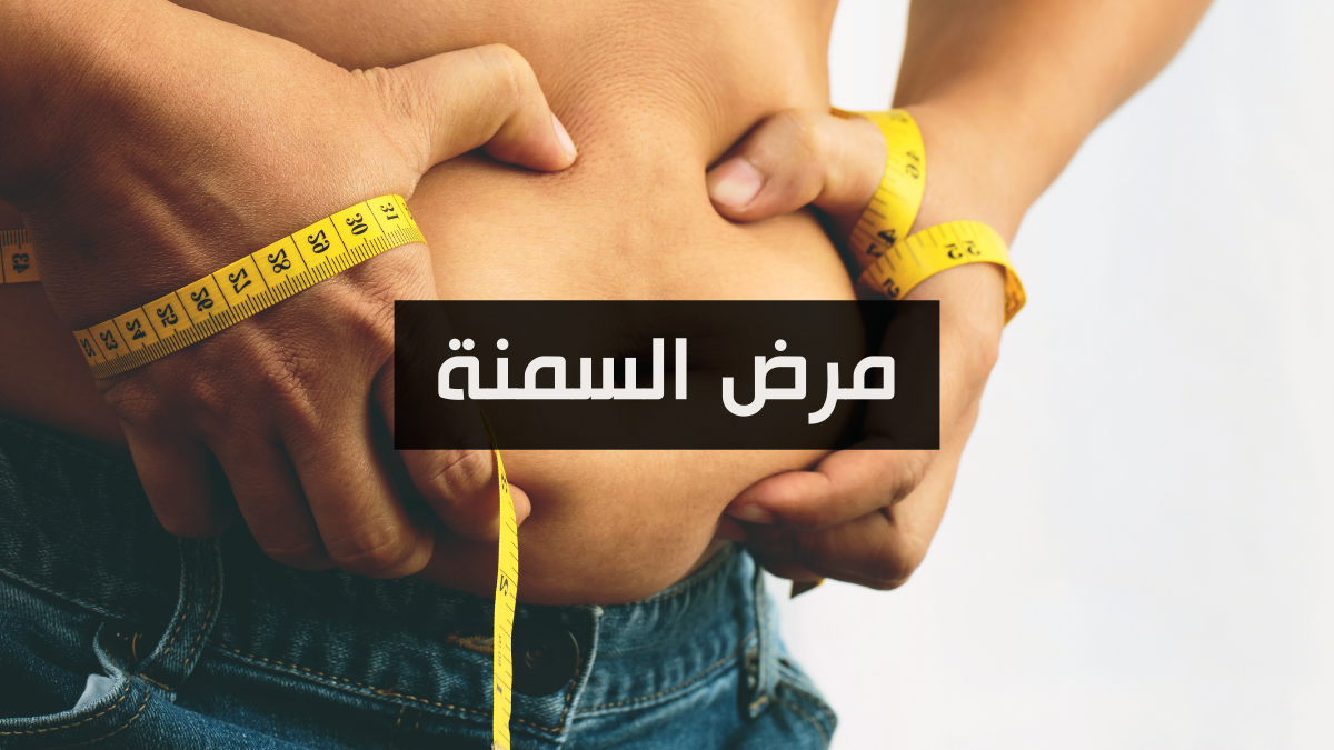 مرض السمنة